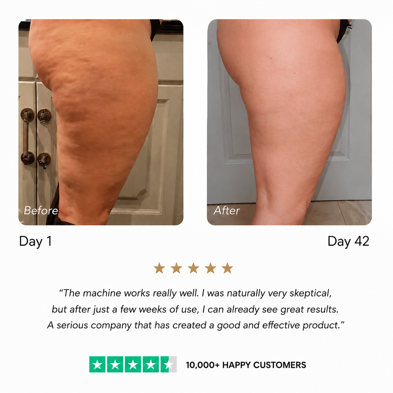 IxB CelluLift™