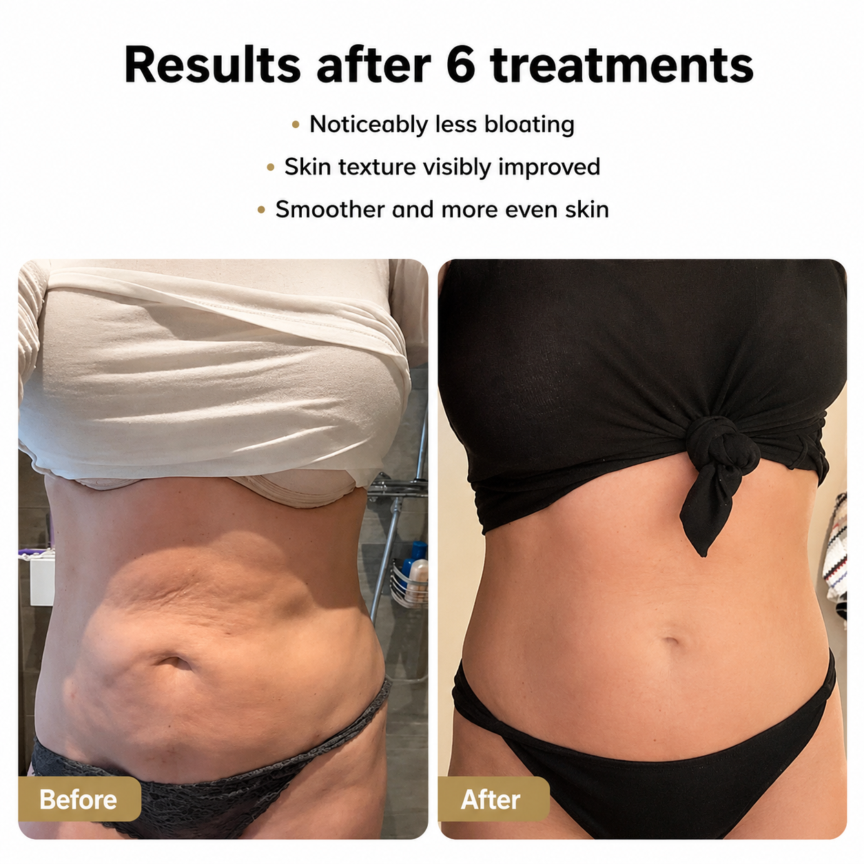IxB CelluLift™